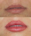 /album/dermomicropigmenta%c3%a7%c3%a3o/p22500071-jpg/