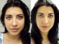 /album/dermomicropigmenta%c3%a7%c3%a3o/priscila-pires-antes-depois-da-micropigmenta%c3%a7%c3%a3o-na-sobrancelha-jpg/