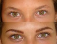 /album/dermomicropigmenta%c3%a7%c3%a3o/antes-1-e1318364873157-jpg/